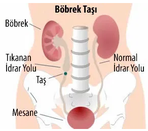 bobrek-tasi