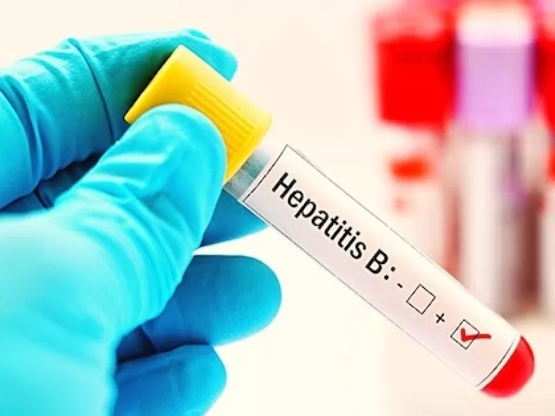 hepatit-b