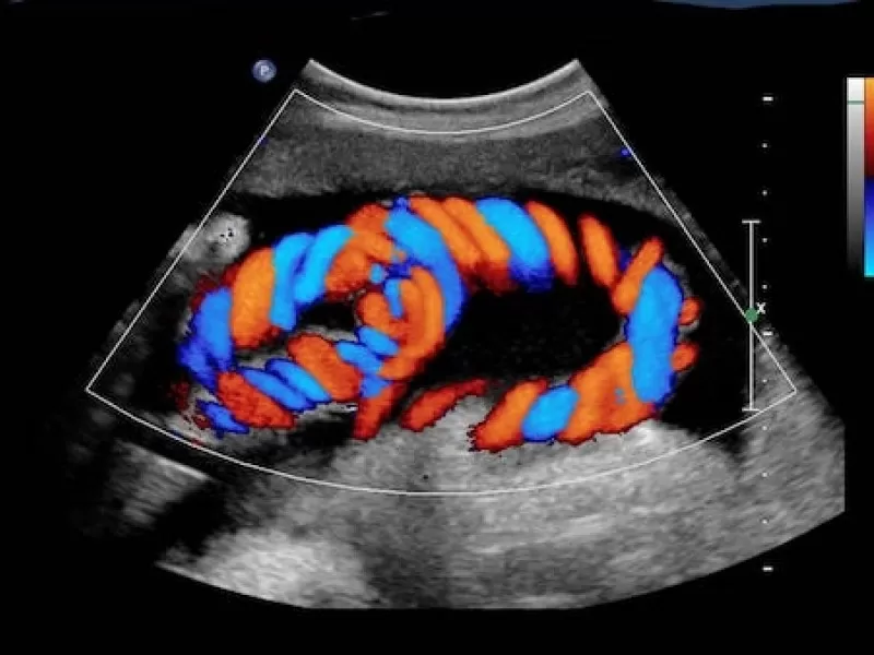 penil-dopler-ultrason-nedir