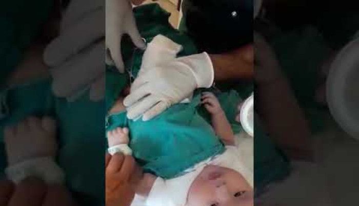 Sunnet,yenidogan sunneti,manisa uroloji,lokal sunnet,manisa sünnet,sünnet ağrılımıdır,6 aylık bebek sünneti bakımı,sünnette neler yapılır,sünnet,bebek sünneti,dr ömür erdem akkaya