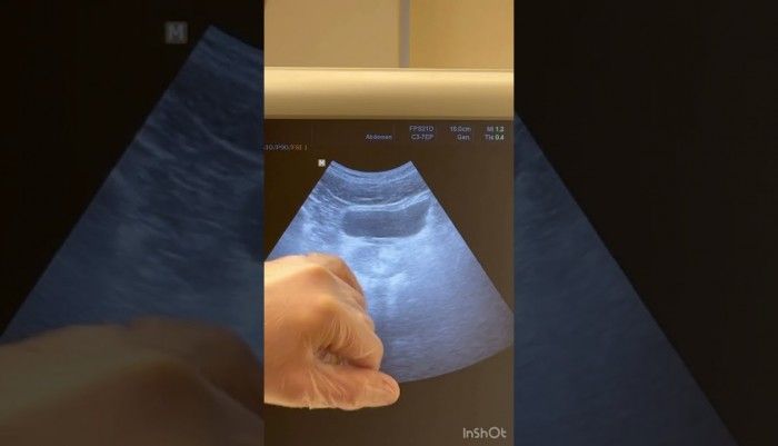 video,paylaşım,kameralı telefon,videofon,ücretsiz,yükleme