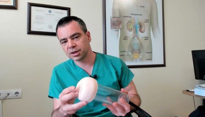 sertleşme sorunu,iktidarsızlık,sertleşme bozukluğu,penis vakum pompası,penis pompası,dr ömür erdem akkaya,manisa üroloji,penis büyütme,penis küçülmesi,penis küçülmesini engelleme,penis vacuum pump,üroloji doktoru,urology doctor,prevent