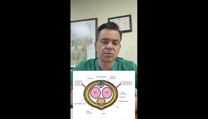 üroloji doktoru,sertleşme bozukluğu,iktidarsızlık,sertleşme sorunu,manisa üroloji,ömür erdem akkaya