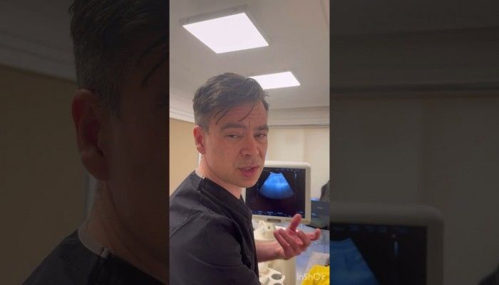 video,paylaşım,kameralı telefon,videofon,ücretsiz,yükleme