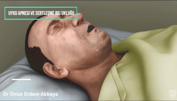Uyku apnesi,horlama,ereksiyon,uyku apnesi nedir,What is sleep apnea?,Sleep apnea,snore,erection