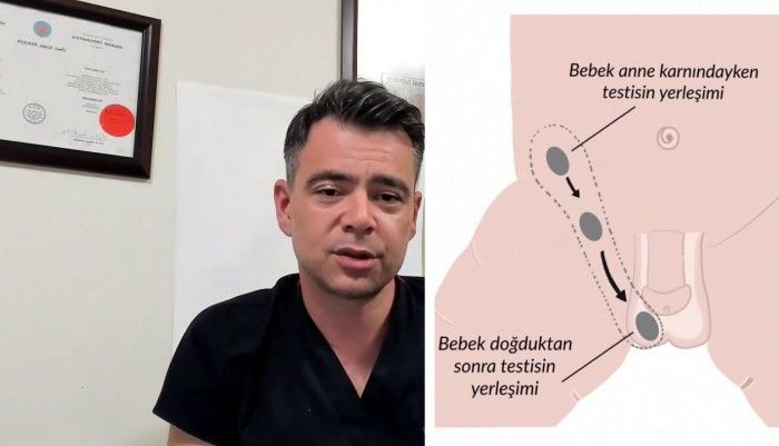 inmemiş testis,dr ömür erdem akkaya,manisa üroloji,manisa sünnet,yenidoğan bebeksünneti,inmemiş testis ameliyatı,inmemiş testis nedir,inmemiş testis tedavisi